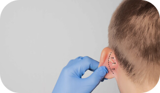 خدمت اتوپلاستی