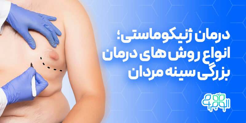 درمان ژنیکوماستی