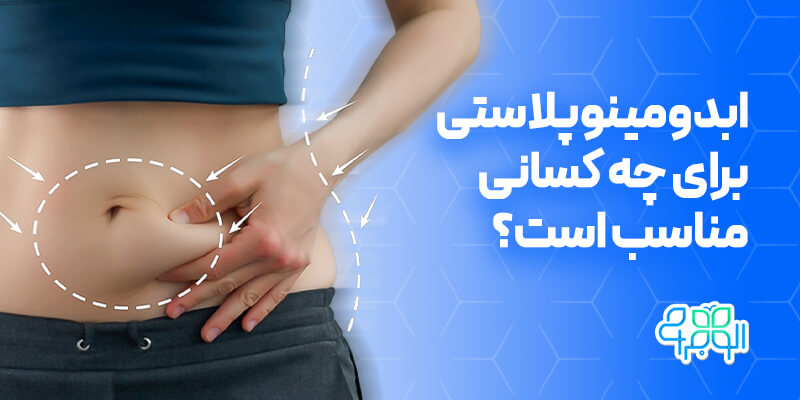 ابدومینوپلاستی برای چه کسانی مناسب است؟