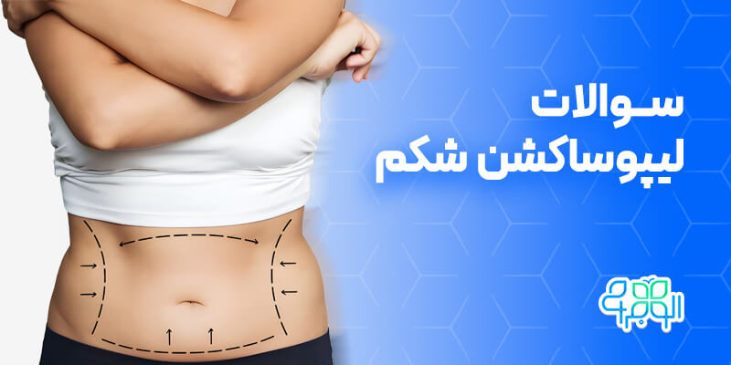 سوالات لیپوساکشن شکم