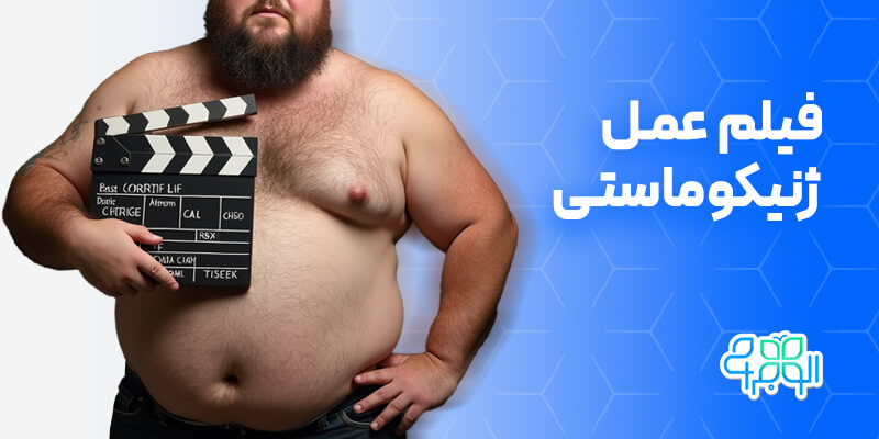 فیلم عمل ژنیکوماستی