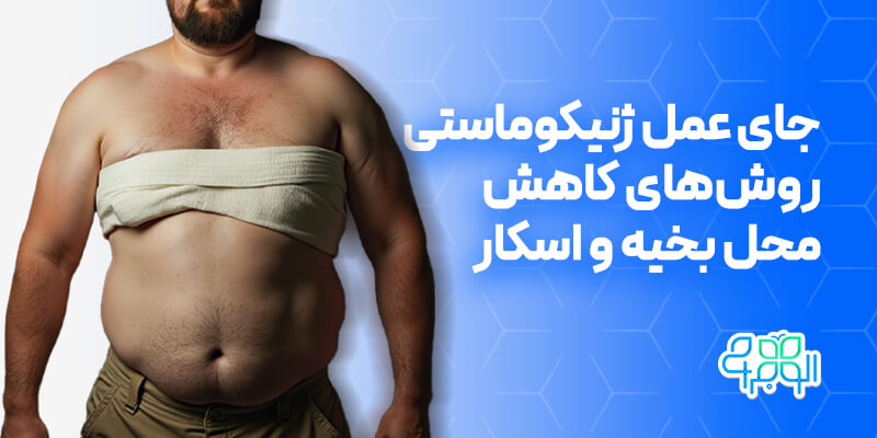 جای عمل ژنیکوماستی