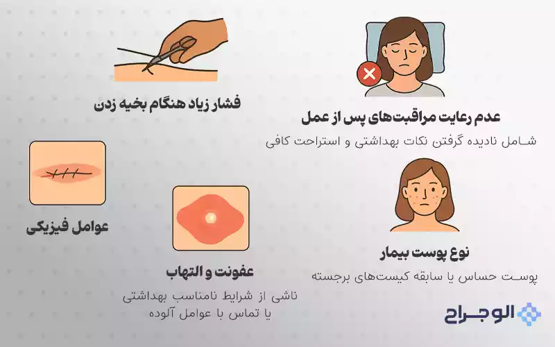 دلایل باز شدن بخیه در ماموپلاستی