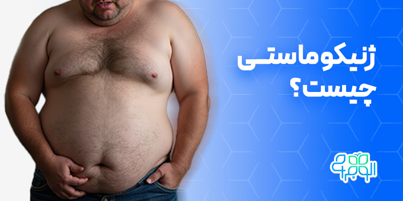 ژنیکوماستی چیست