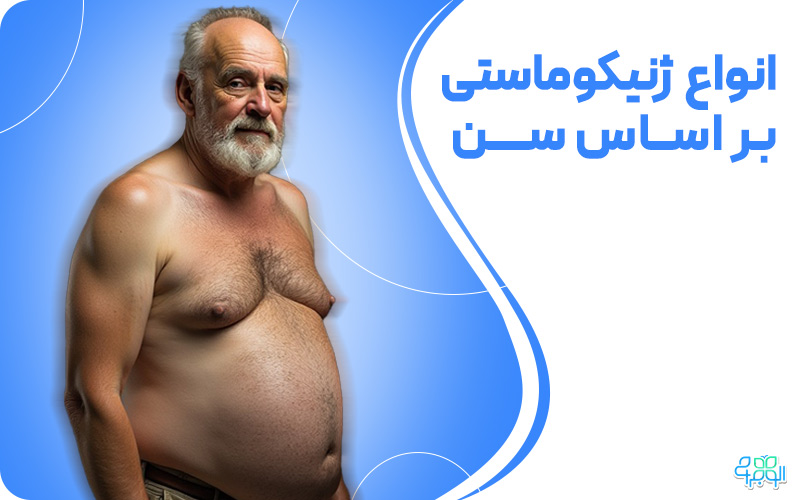 انواع ژنیکوماستی بر اساس سن