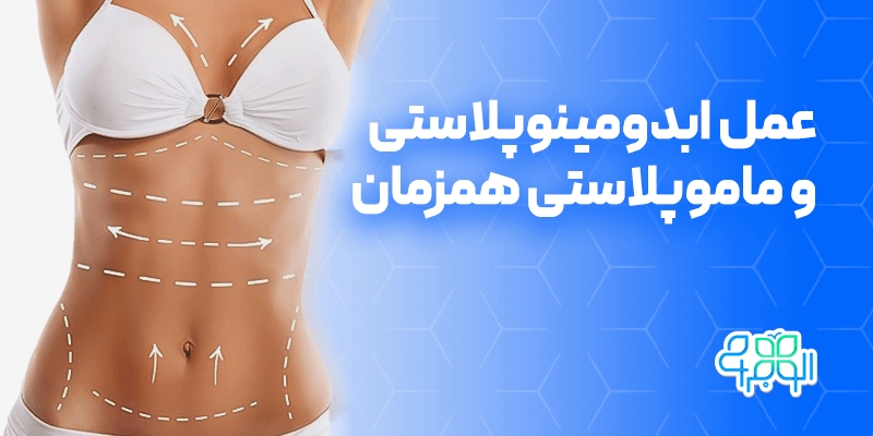 عمل ابدومینوپلاستی و ماموپلاستی همزمان